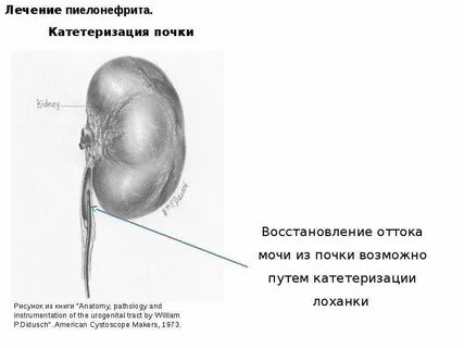 Почки восстанавливаются