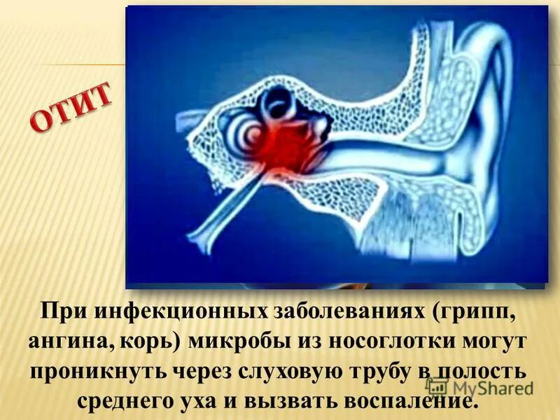 Слуховой анализатор отит. Болезни слухового анализатора биология 8 класс. Анализатор слуха биология 8. Слуховой анализатор болезни отит. Гигиена органа слуха 8 класс