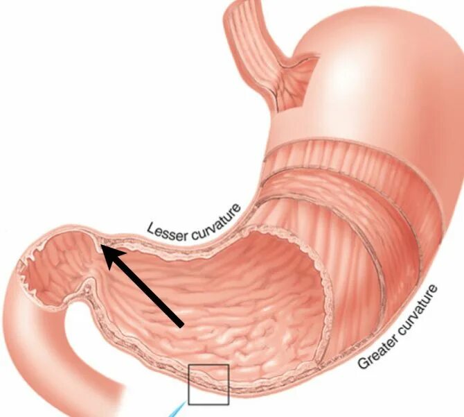 Между пищеводом. Сфинктеры желудка анатомия. Кардиальный сфинктер желудка анатомия.