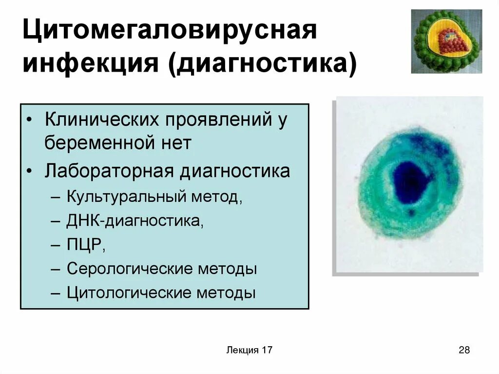 Цмв инфекция что это. Цитомегаловирусная инфекция клинические проявления. Цитомегаловирус cytomegalovirus,. Лабораторная диагностика ЦМВ.