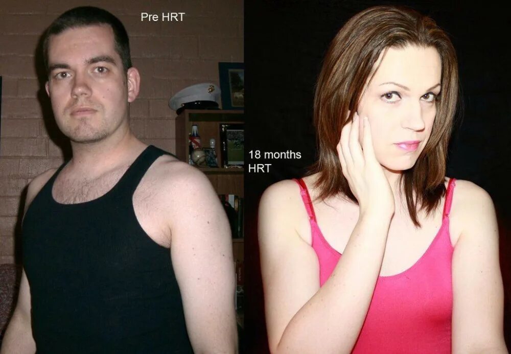 трапы до и после гормонов. мужчина стал женщиной гормоны. трансгендер мтф гормонотерапия. Mtf hrt body. смена пола.