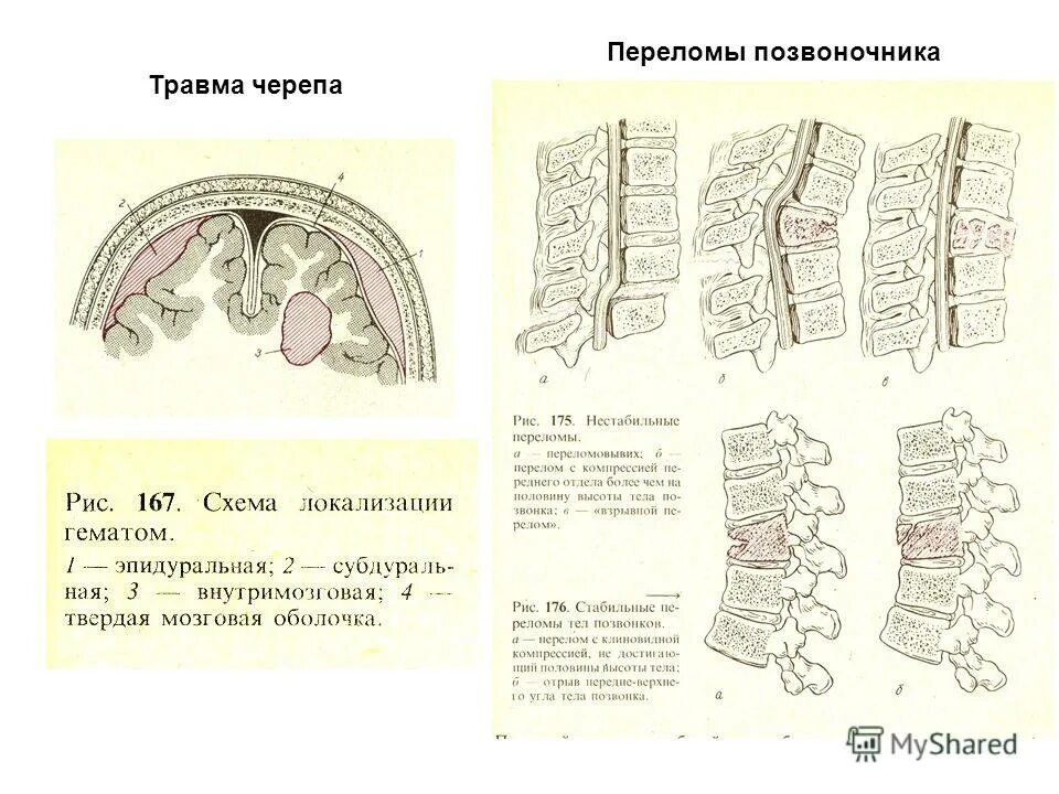 Периоды травмы позвоночника. Периоды травмы позвоночника. Периоды травмы позвоночника. Периоды травмы позвоночника. Периоды травмы позвоночника.
