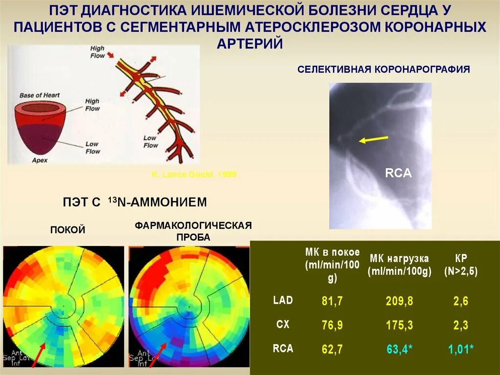 Диагностика ишемии. ПЭТ диагностика. Позитронно-эмиссионная томография сердца. ПЭТ радионуклидная диагностика. ПЭТ В кардиологии.