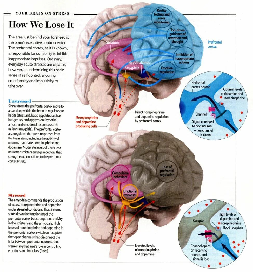 Стрессы головной мозг
