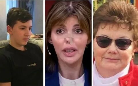 Жена аршавина до и после пластики