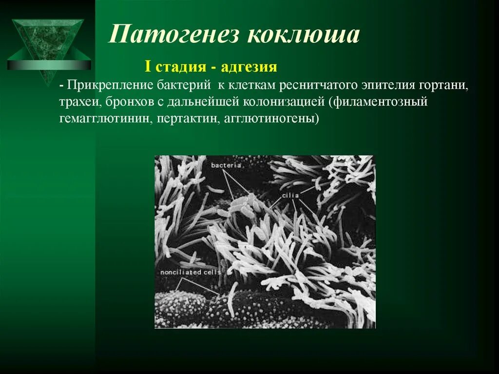 Патогенез коклюша. Коклюш этиология. Патогенез коклюша микробиология. Филаментозный гемагглютинин.