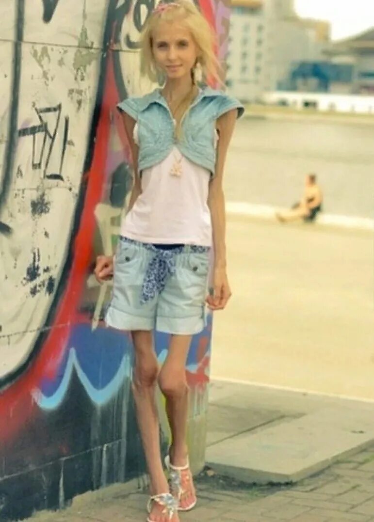 Вешу 23. Девушка 28 кг. Вешу 23. Ксюша бубенко анорексия. Дочь экс-вратаря «зенита» вячеслава малафеева сливы.