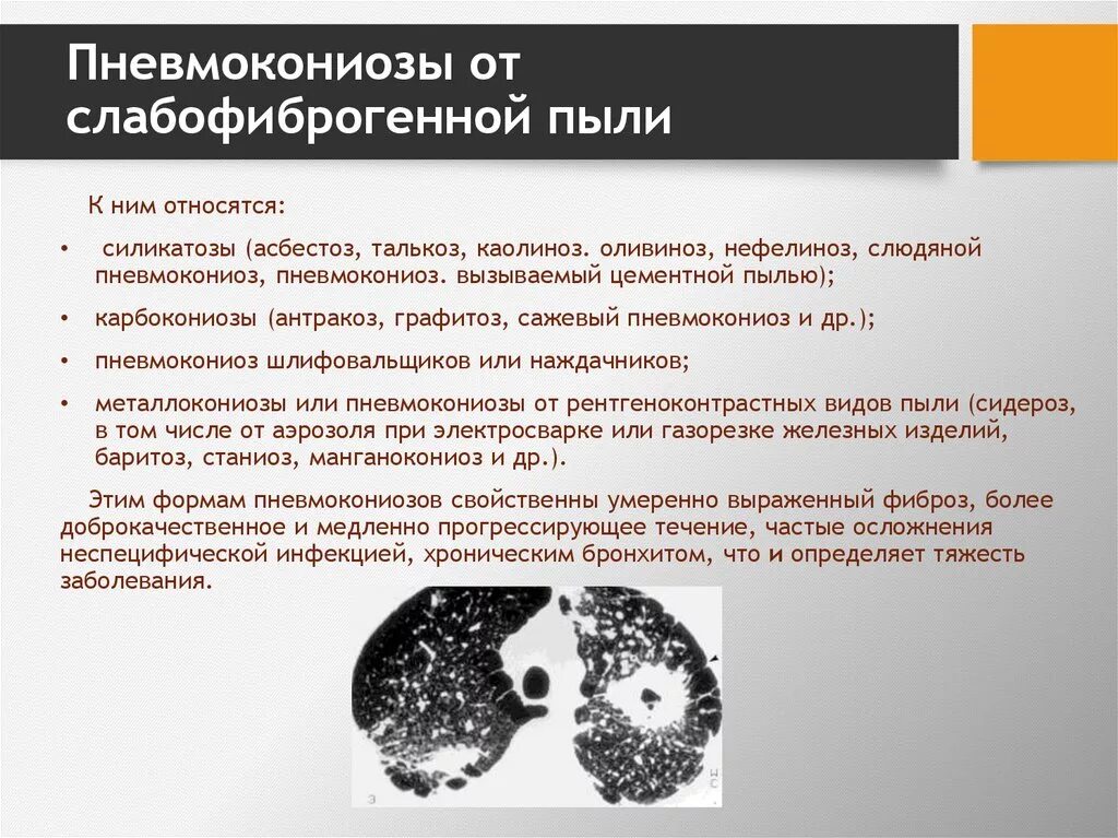 Фиброгенность по отношению к аэрозолям чем является