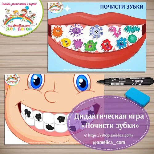 Чистим зубы играя. Игрушка с зубами и липучками. игры на липучках зубы. игра почистим зубки. липучки для зубов для нитей.