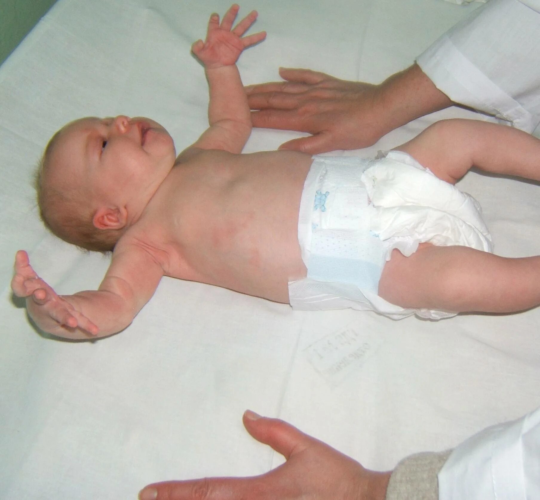 дети моро. эффект моро у новорожденного. эффект моро. рефлекс моро у грудничка. эффект моро.