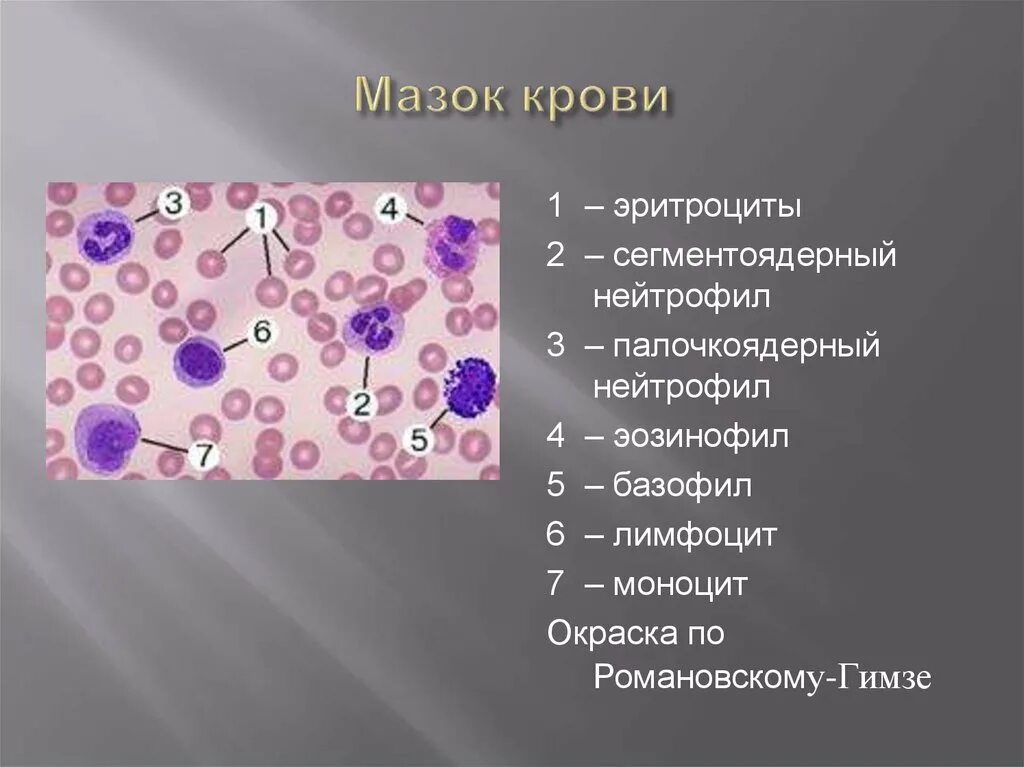 Клетки крови мазок гистология. Мазок крови : эритроцит, нейтрофил,эозинофил. Клетки крови микроскопия. Мазок периферической крови с микроскопией.