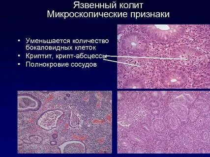 Препарат колотой