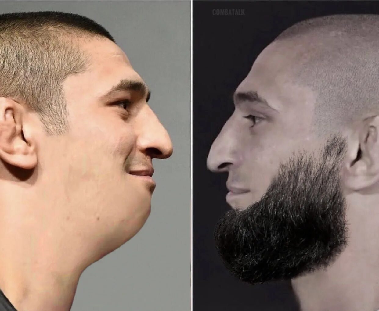 He has a beard