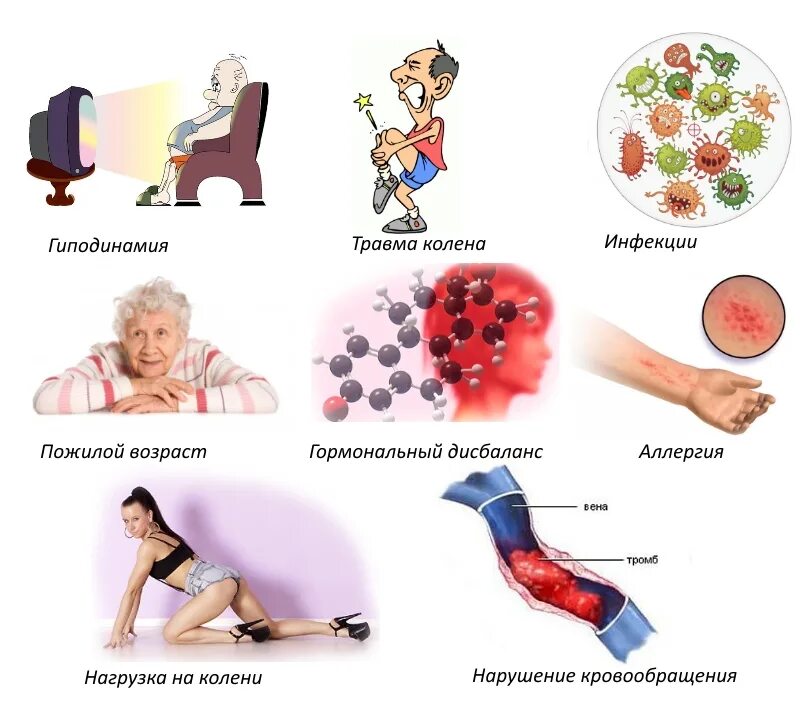 Нарушение гиподинамии. Гиподинамия симптомы. Последствия гиподинамии. Последствия гиподинамии картинки. Причины гиподинамии.