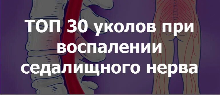 Какие уколы от защемления нерва. Воспаление седалищного нерва уколы препараты. препараты при защемлении седалищного нерва уколы. уколы при воспалении седалищного нерва. уколы от седалищного нерва внутримышечно.