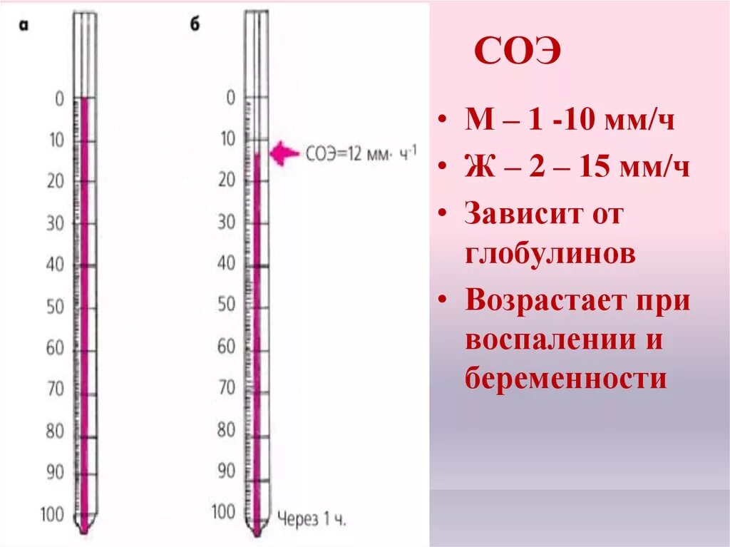 Методика измерения СОЭ В крови. Метод Панченкова СОЭ. СОЭ метод Панченкова норма. СОЭ метод Панченкова норма у женщин.