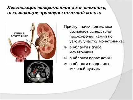 Через какое время выйдет камень