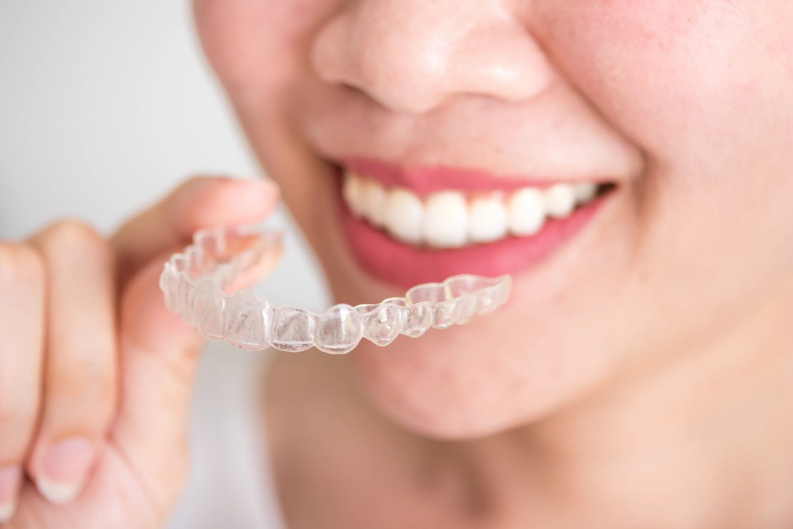 Элайнеры это. Каппы инвизилайн invisalign. элайнеры invisalign. инвизибл элайнеры.