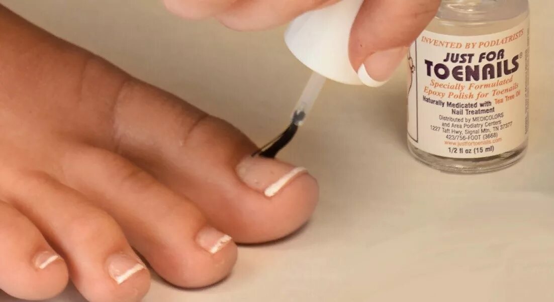 Эффективное лечение грибка ногтей рук. Лак для ногтей ног лечебный. Средство от грибка ногтей на ногах.
