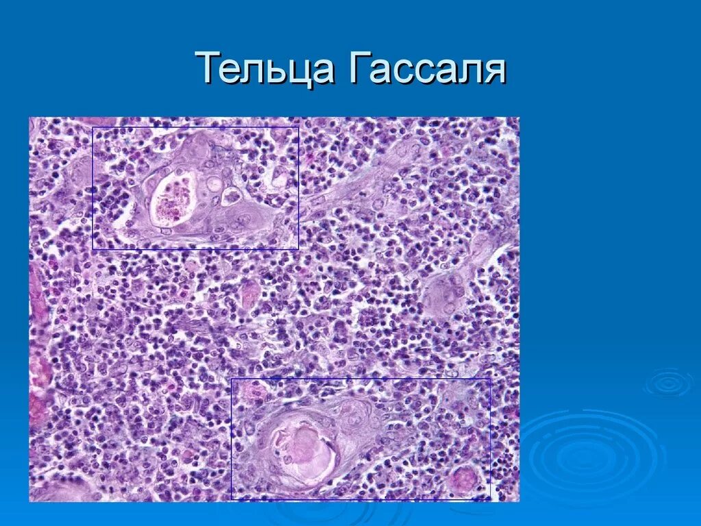 Многочисленные мелкие тельца. Тельца Гассаля тимус гистология. Тимус гистология тимоциты тельца Гассаля. Слоистые эпителиальные тельца Гассаля. Тельца Гассаля строение гистология.