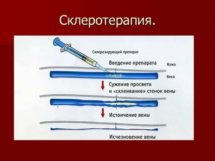 Склероскопия