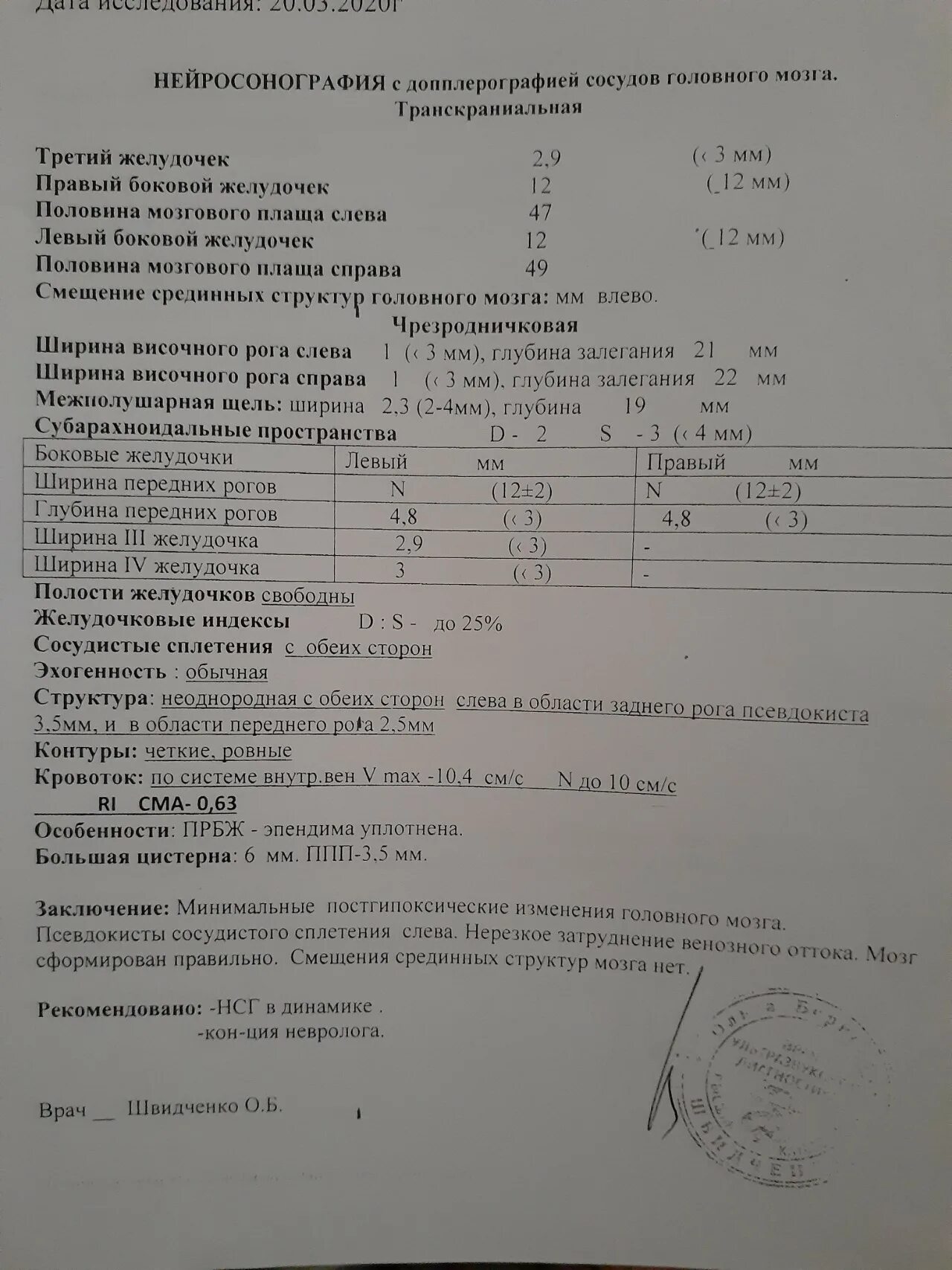 Нормы желудочков мозга у плода. Нормы желудочков головного мозга у плода. Боковые желудочки норма. Ширина боковых желудочков. Норма боковых желудочков головного мозга у плода.