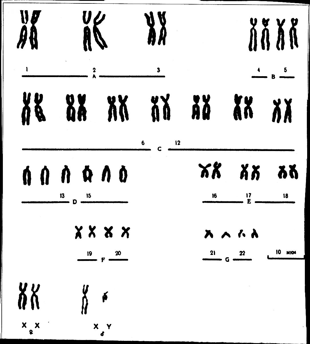 Кариотип аутосомы и половые. Кариотип человека аутосомы половые хромосомы. Идиограмма кариотипа человека. Кариотип человека 22 аутосомы.