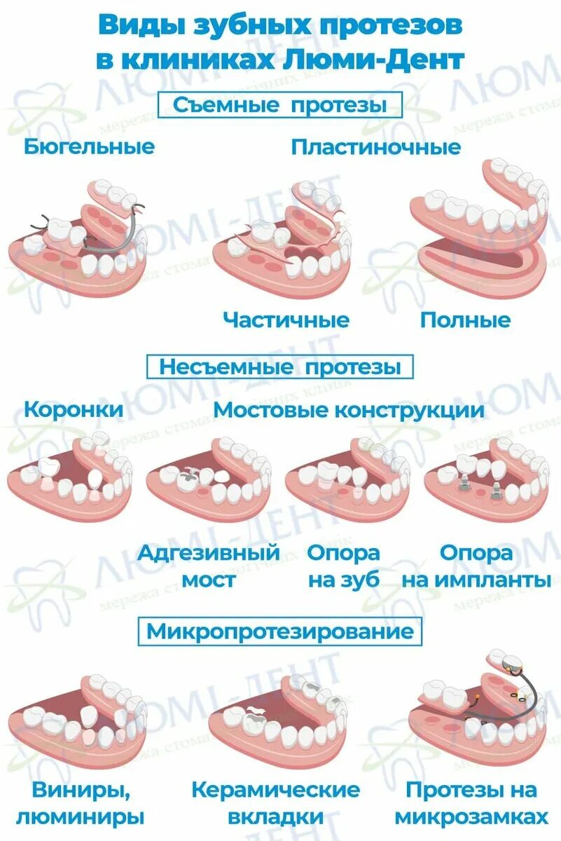 Протезирование зубов инвалидам 3 группы. Протезирование зубов какие виды протезов бывают. Какие бывают съемные протезы. Какие бывают протезы для зубов съемные. Разновидности съемных протезов.