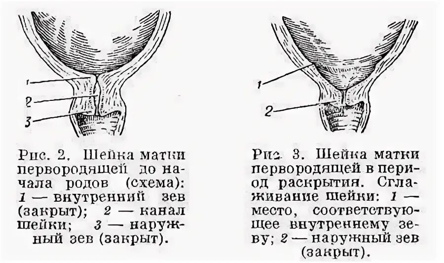 Маточный зев. Маточный зев при беременности. Шейка матки наружный зев. Шейка матки наружный и внутренний зев.