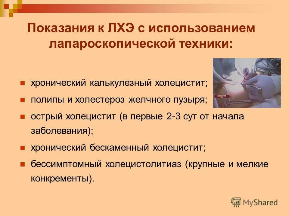 Холецистэктомия мкб 10. Калькулезный холецистит мкб 10. Хронический холецистит код по мкб 10. Калькулёзный холецистит мкб 10 код. Хронический калькулезный холецистит мкб 10.