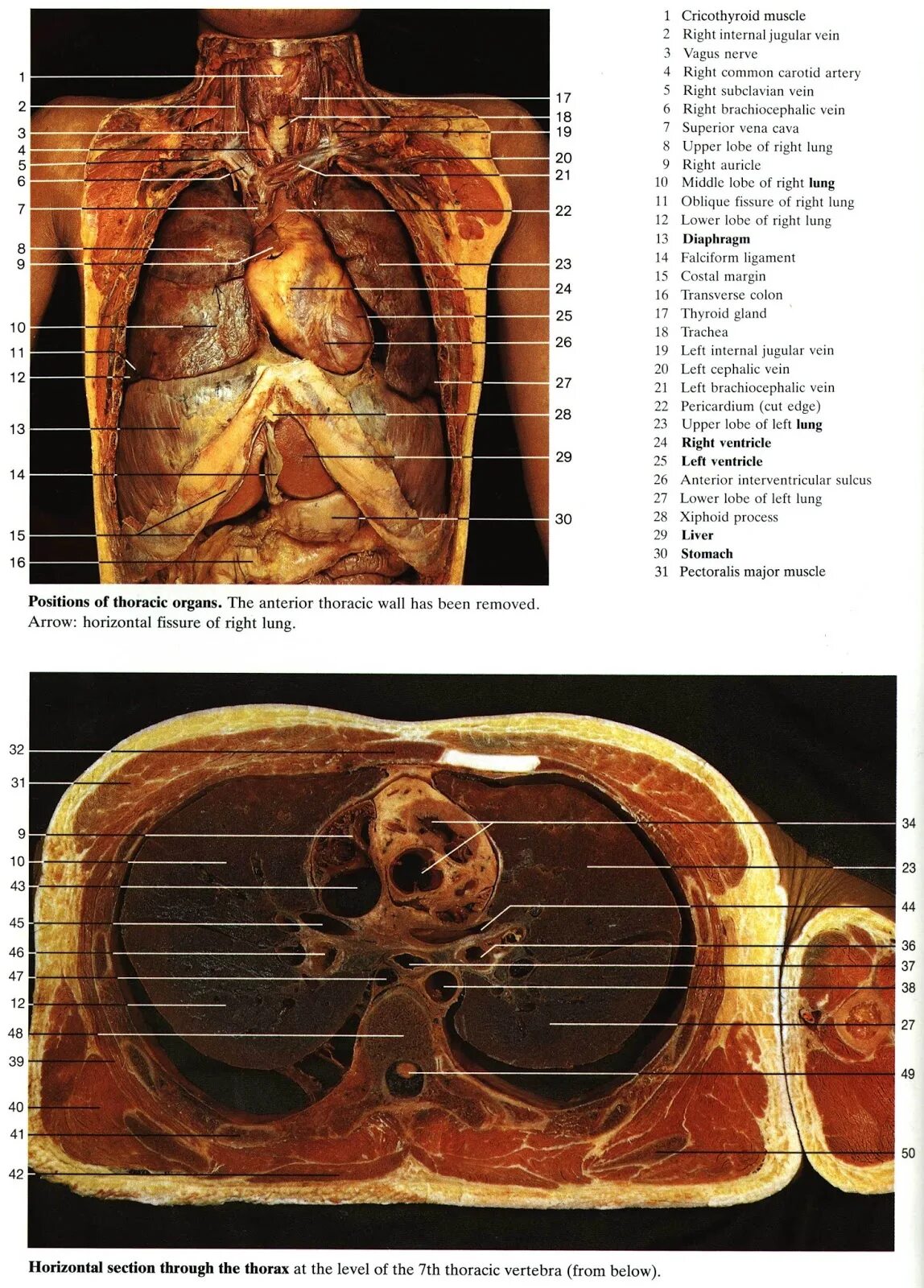 Анатомия грудной клетки внутренние органы. Анатомический атлас грудной клетки. Строение грудной клетки женщины анатомия с органами. Грудная клетка человека анатомический атлас.