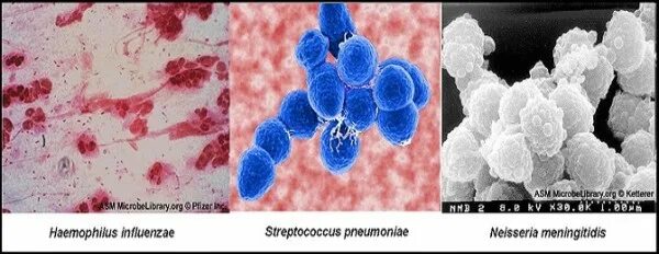 Streptococcus pneumoniae haemophilus influenzae streptococcus. Haemophilus haemolyticus в норме.