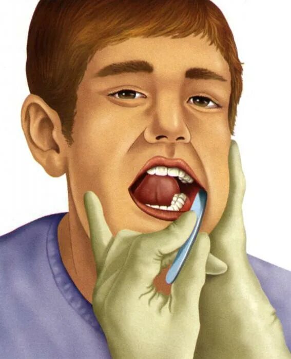 Полоскание рта пациента. Протирание полости рта. Протирание полости рта и зубов. Уход за слизистыми полости рта. Обработка полости рта больных.