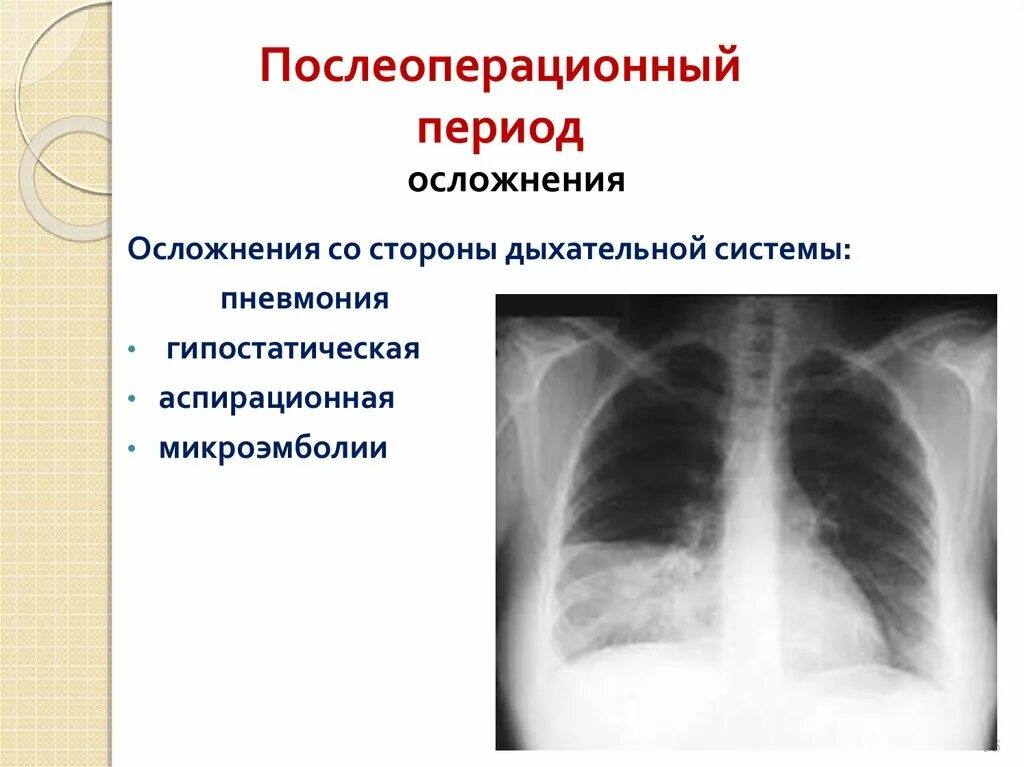 Послеоперационные осложнения дыхательной системы. Осложнения дыхательной системы после операции. Послеоперационные осложнения со стороны дыхательной системы. Осложнения в послеоперационном периоде со стороны органов дыхания. Гипостатические изменения в легких