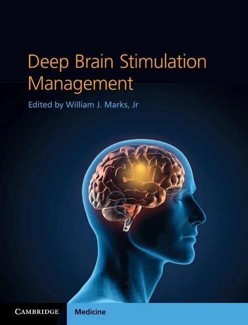 Deep brain. Deep Brain stimulation. Мозг человека менеджмент. Deep Brain stimulation Williams book.