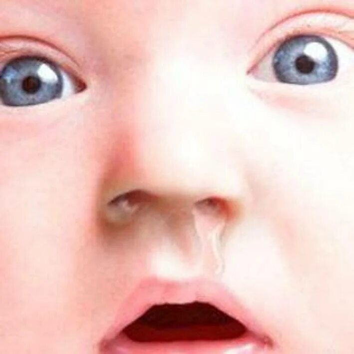 Заложенность носа у ребенка 3 года. Прорезывание зубов и сопли у ребенка. Ринит при прорезывании зубов.