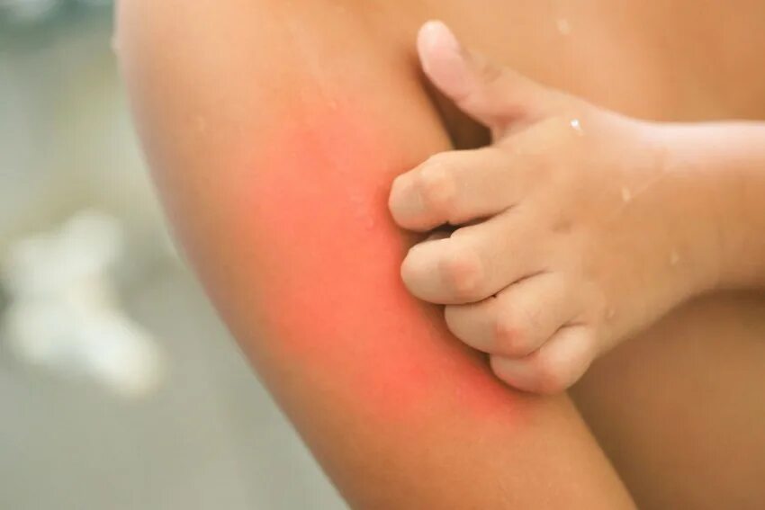 People Scratch the Itch with Hand Stock Photo - Image of skin, hands: 156930290