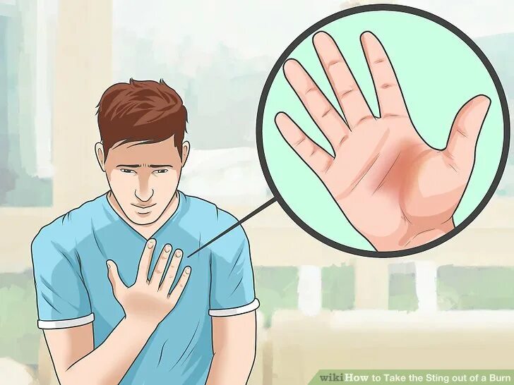 Бочка для костра. Невосприимчивость к боли. Электрический ожог вектор. Put on. Put something on the back burner.