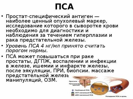 Жена делает массаж простаты