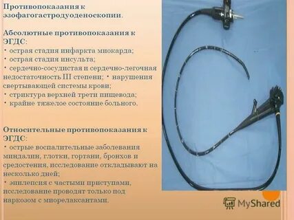 Что такое эгдс