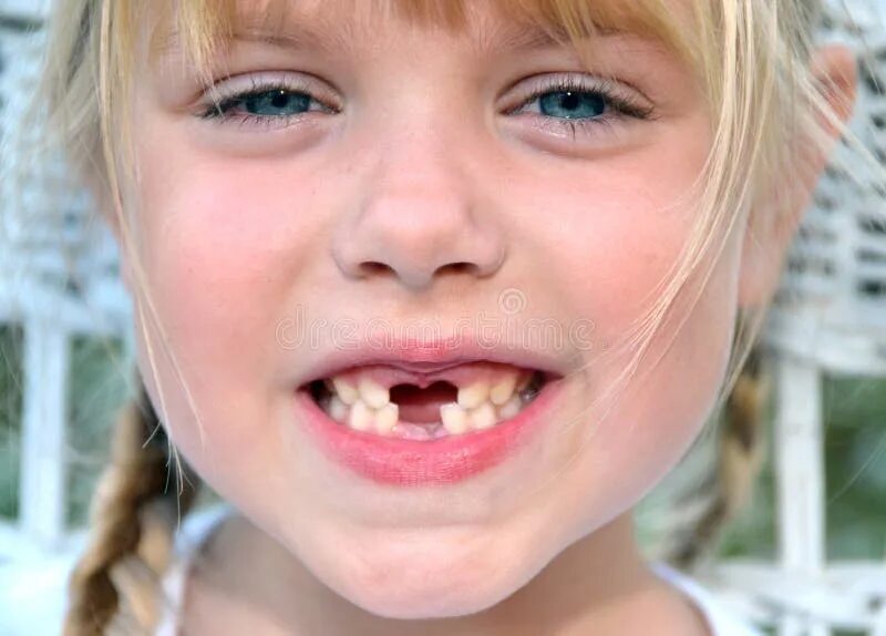Маме полный рот. Девушка без передних зубов. Беззубая детская улыбка. Девочка без передних зубов.