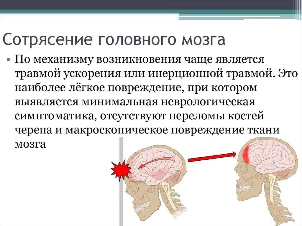 После сотрясения. Три основных признака при сотрясении головного мозга.. Вторичные симптомы сотрясения мозга. Сотрясени еголовоного мозга. Сотрясение головы симптомы.