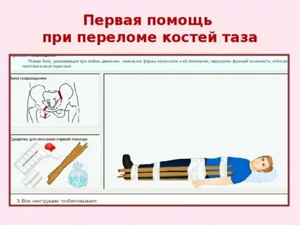 Действия при переломах бедра