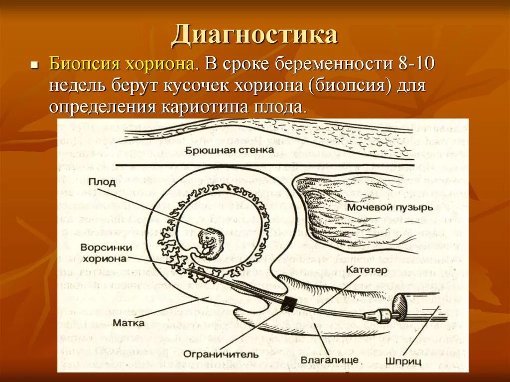 Низкий хорион что это. Ворсинчатый хорион. Строение хориона. Низкий хорион что это. Функции хориона зародыша.