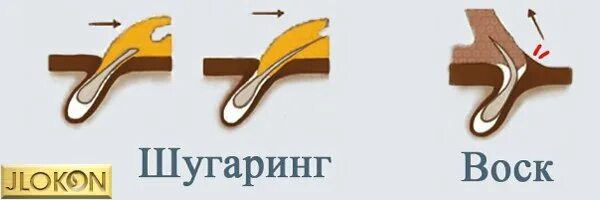 Депиляция против роста волос. Шугаринг против роста волос или по росту. Шугаринг по росту волос. Депиляция воском по росту или против роста волос. Депиляция воском против роста или по росту