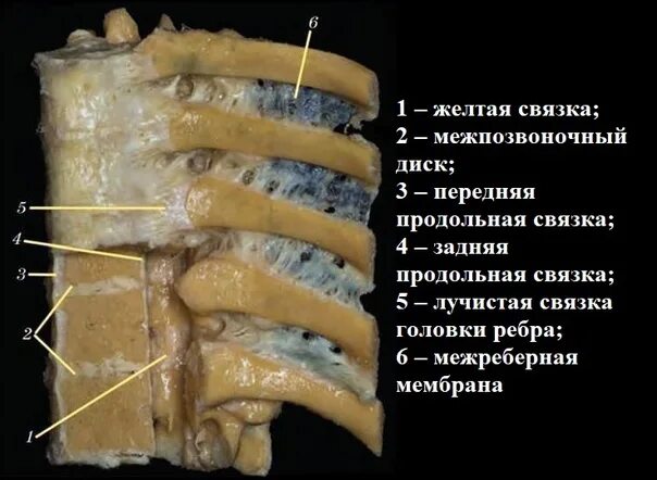 Желтая связка позвоночника анатомия. Связки позвоночника. Связки позвоночного столба анатомия. Желтая связка позвоночника. Надостистая связка позвонков.