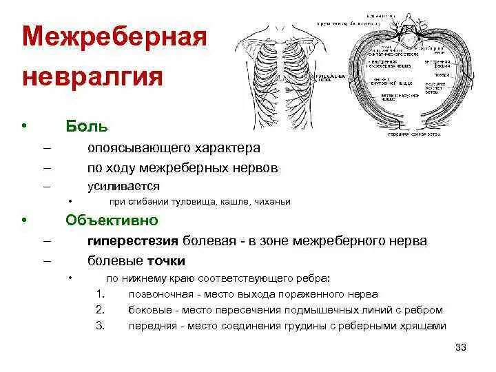 Межреберная невралгия лечение в домашних условиях слева