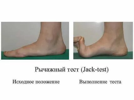 Jack tests