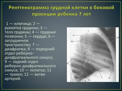 Граница средней и нижней трети грудины
