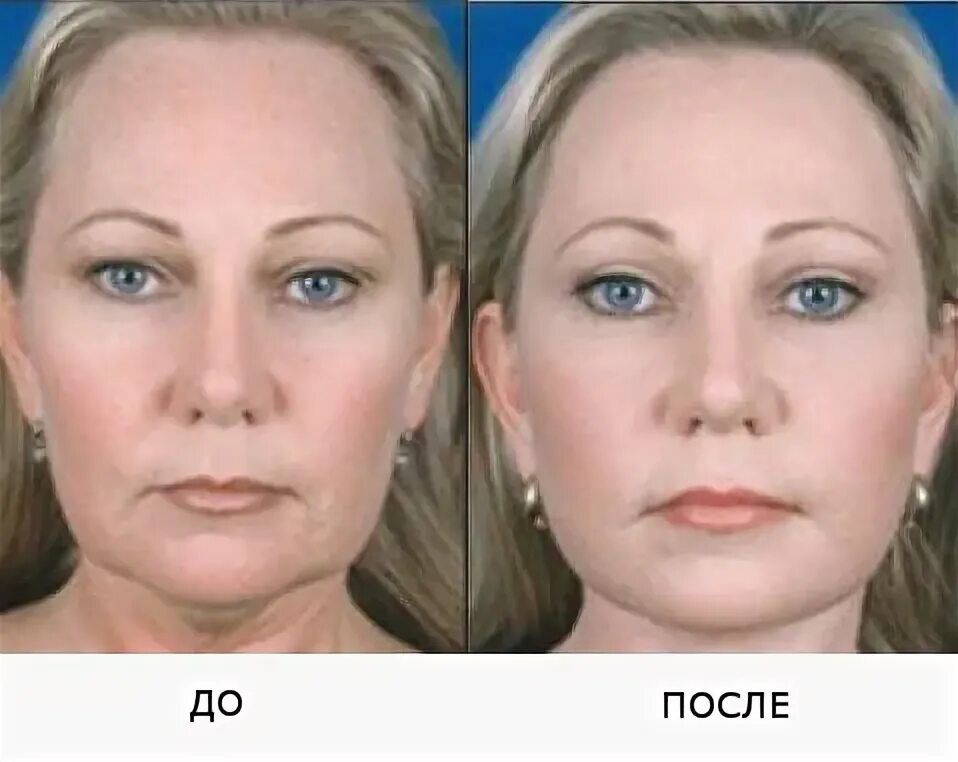Его применение на лице в